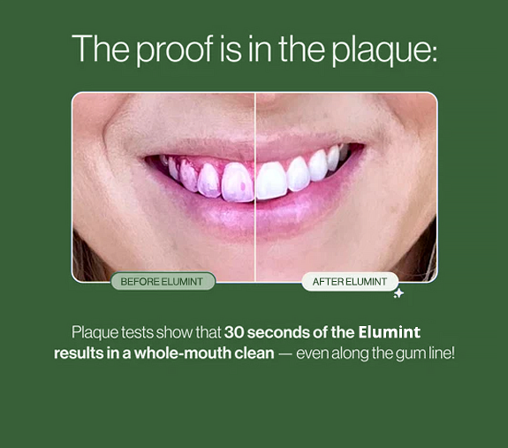 EluMint™ Sonic Pro